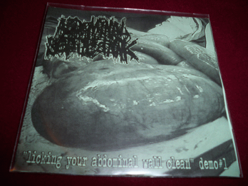 Abdominal Septic Tank : Licking Your Abdominal Wall Clean